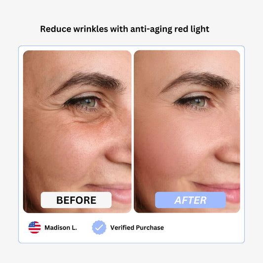 True Beauty Glow Face & Neck Lifting Device