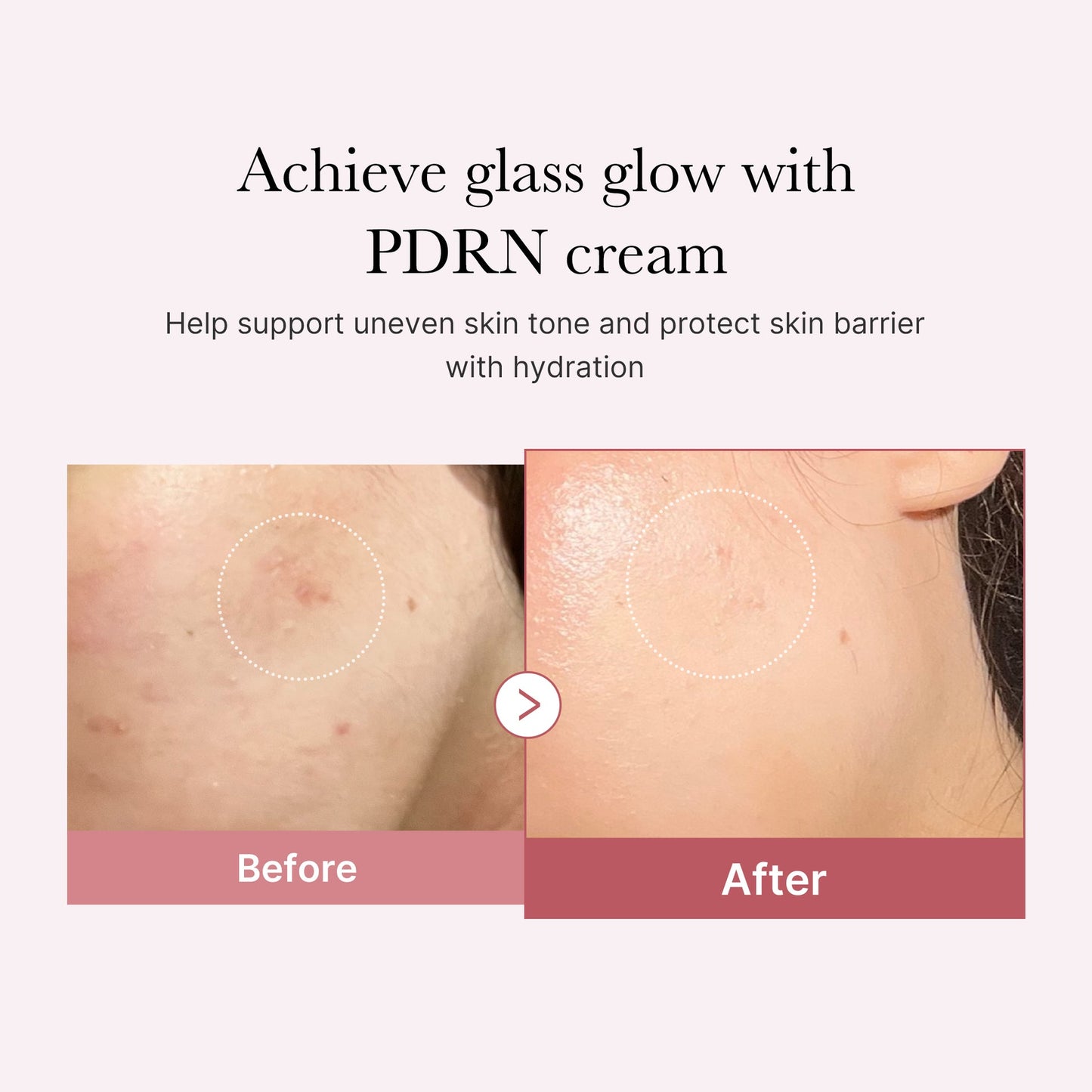 Medicube PDRN Glow Repair Cream